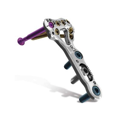 Acu-Loc 2: image from Acumed